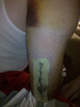 Illustration for article titled Blood Writes: The Horror Of Throwing A Pitch And Having Your Arm Snap In Half